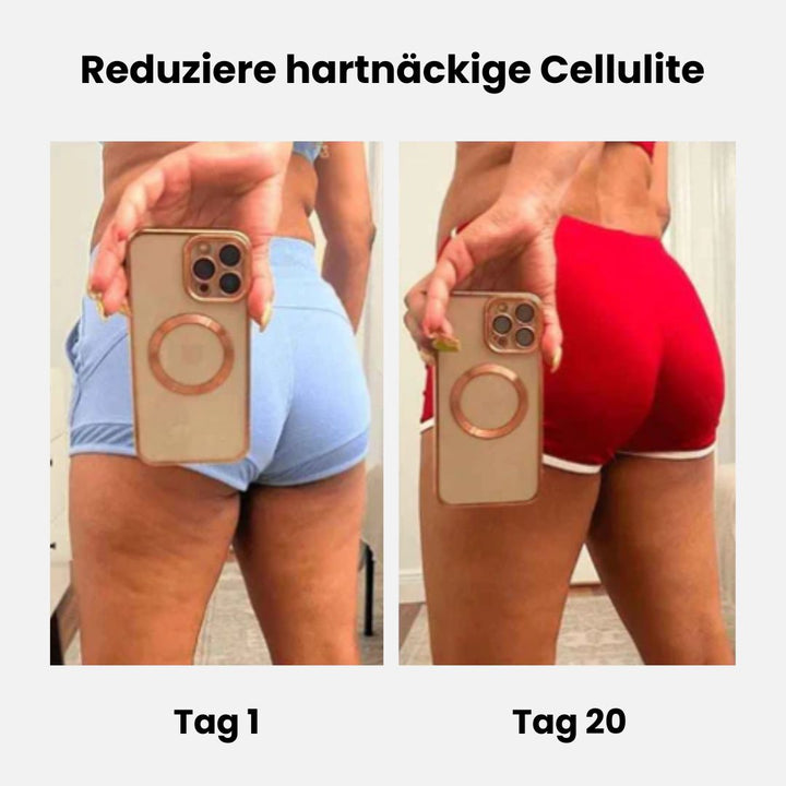 CelluLuxe - Pro NEU