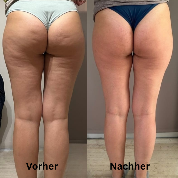 CelluLuxe Pro - Straffe deinen Körper in nur 10 Minuten täglich ganz bequem von zu Hause.