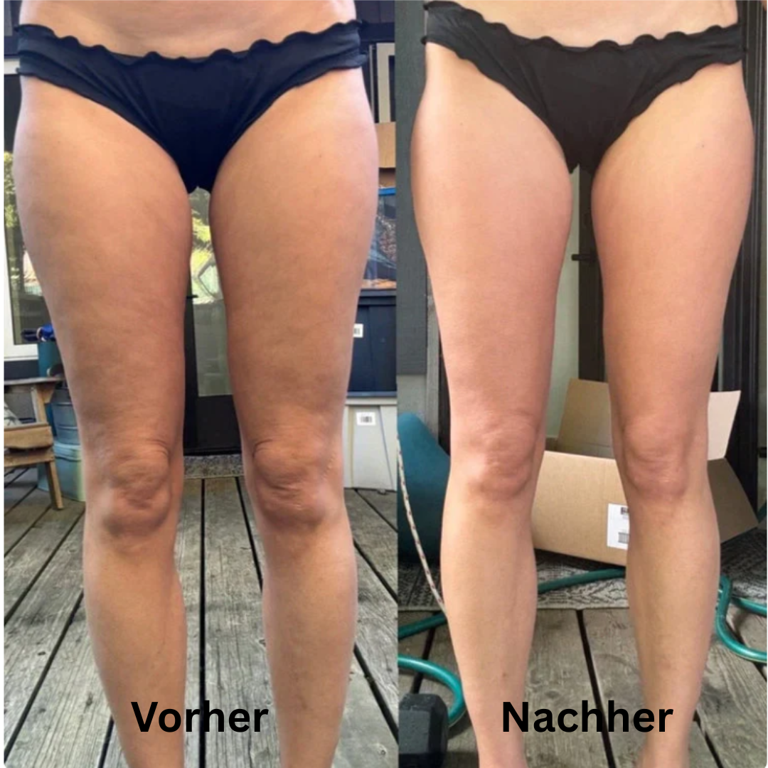 CelluLuxe Pro - Straffe deinen Körper in nur 10 Minuten täglich ganz bequem von zu Hause.