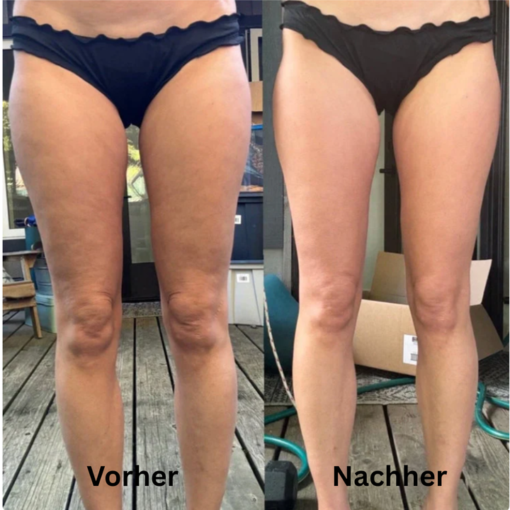 CelluLuxe Pro - Straffe deinen Körper in nur 10 Minuten täglich ganz bequem von zu Hause.