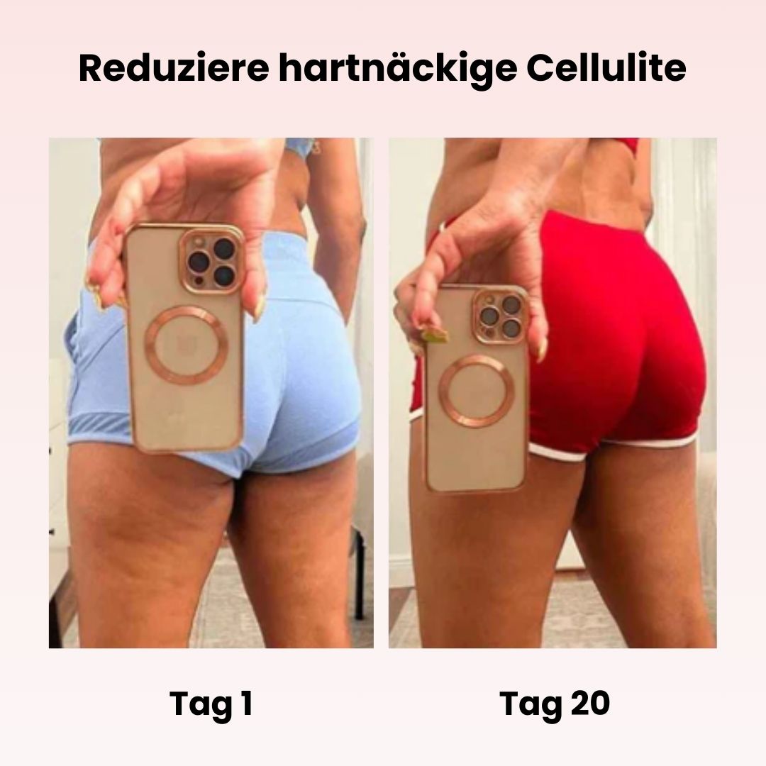 CelluLuxe - Das Original