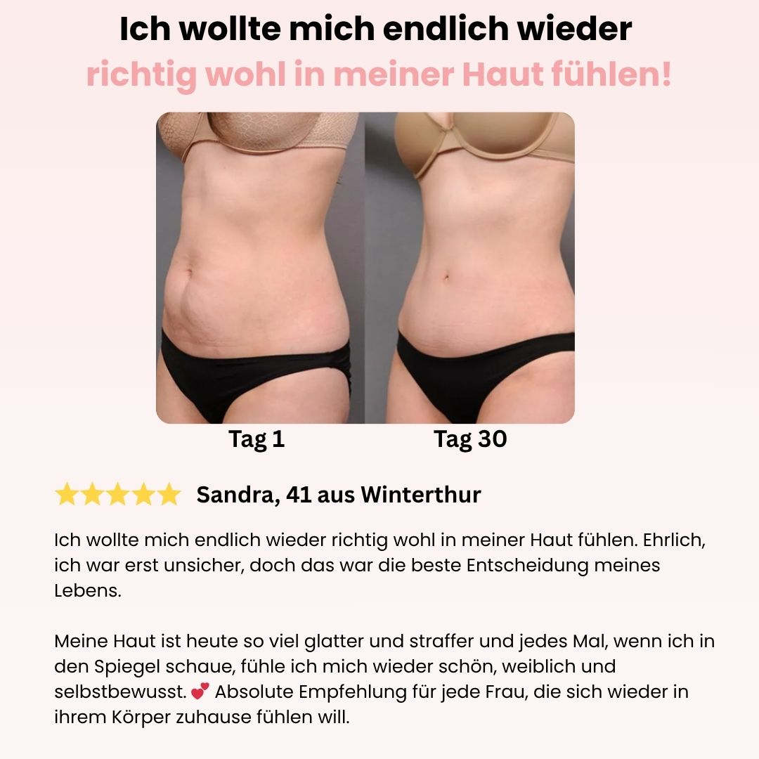 CelluLuxe Pro - Straffe deinen Körper in nur 10 Minuten täglich ganz bequem von zu Hause.